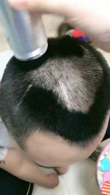 廉价纸擦脸肿成猪头