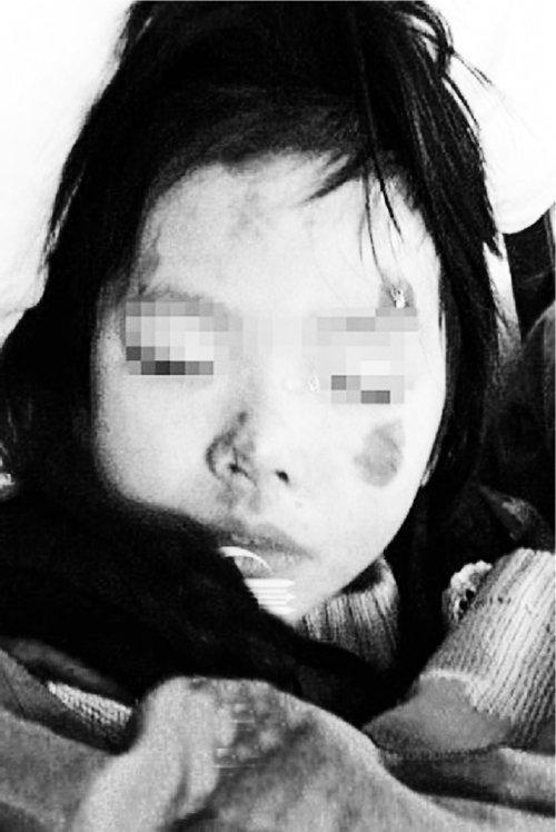 儿童遭父亲殴打致死