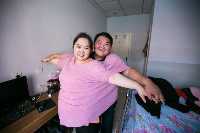 夫妻相爱7年 女方从168斤胖到350斤